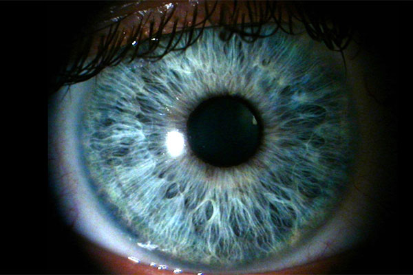 А Вы знали, что все люди с голубыми глазами имеют эту уникальную особенность?